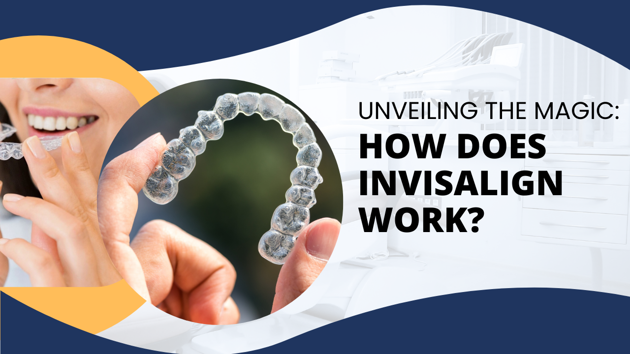 how long do aligners take to work